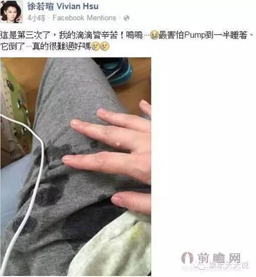 又出事！徐若瑄宝宝被质疑患有“斜头症”！女神命运多舛！