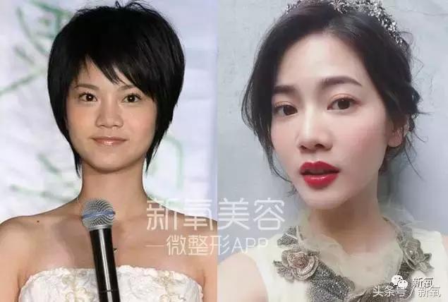 因比同组合成员丑而自卑整形，15年后变少女再演女主却没人认得了