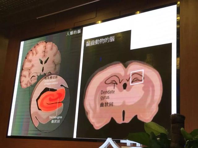 教孩子需要懂点脑科学