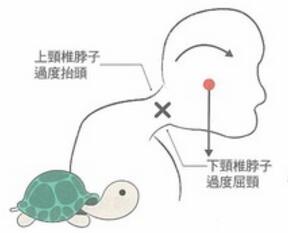 新加坡学生族和上班族都要注意了，当心成“乌龟颈”