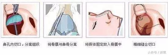 比起傻白甜，更想住在风月美人的眼角眉梢