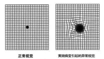 「科普」认识一下眼睛的心脏——黄斑