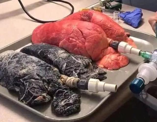 比香烟还毒7倍，已在多国被禁！你身边有人用吗？