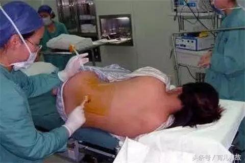 从一蹶不振到魅力四射，宝妈参加杭州产后修复中心真实经历