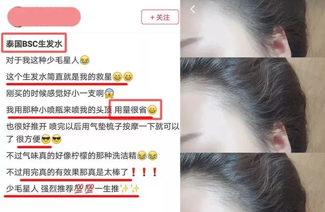 一抹唤醒“瘫痪”毛囊，头发就这么长出来，拯救消失的发际线！