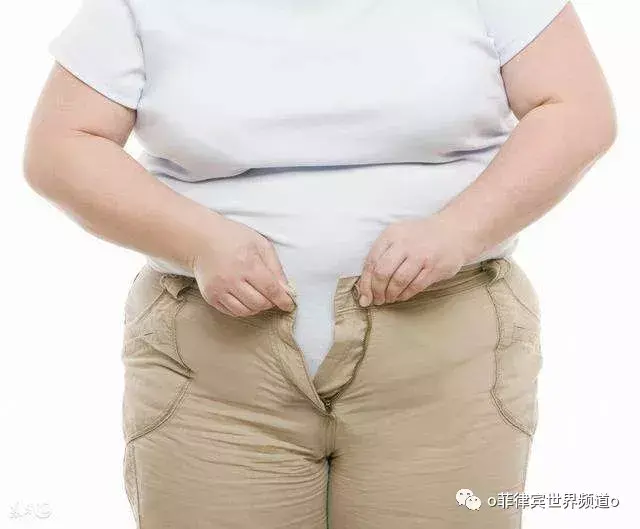 因富裕和不健康饮食 5.1%菲律宾成年人肥胖