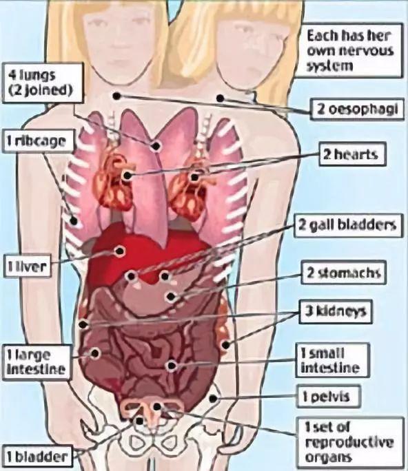 最诡异的双头连体人，两个大脑如何控制同一个身躯？