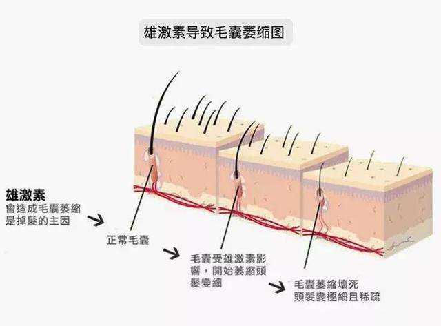 为了防脱发，他们研究了113年！洗完头发又浓又密