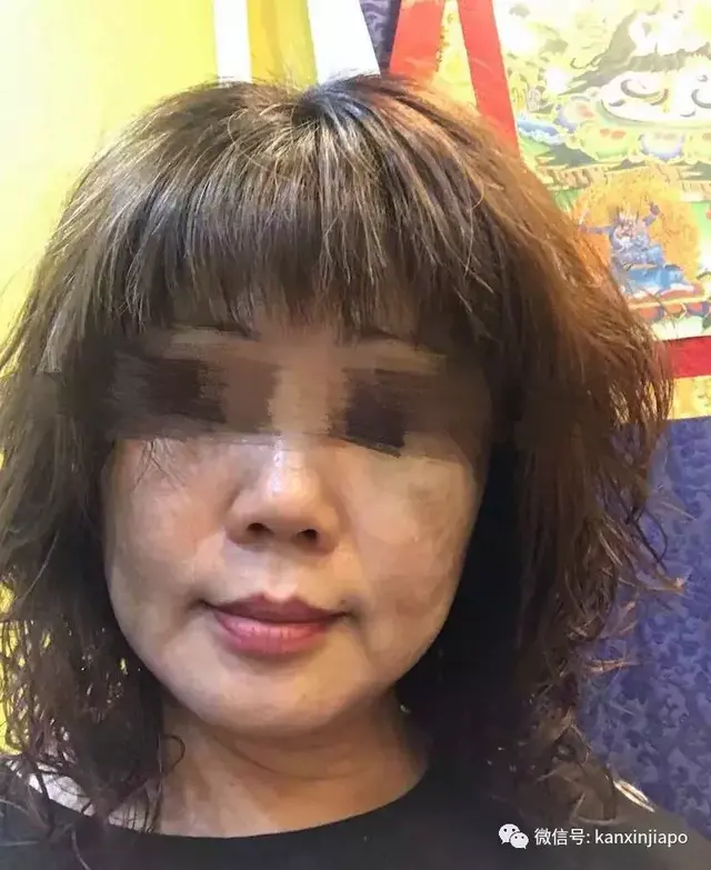 世上只有懒女人没有丑女人？我勤快又舍得花钱，但还是满脸斑