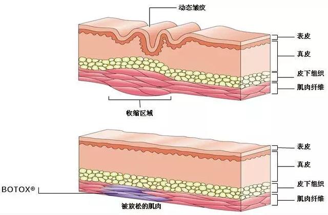 医美界的“神仙水”，除了瘦脸，它还能让你美这么多