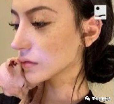 刘梓晨前女友脸整到辣瞎眼，还骗粉丝钱