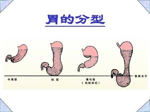 胃癌“候选人”，快看你是否在其中！