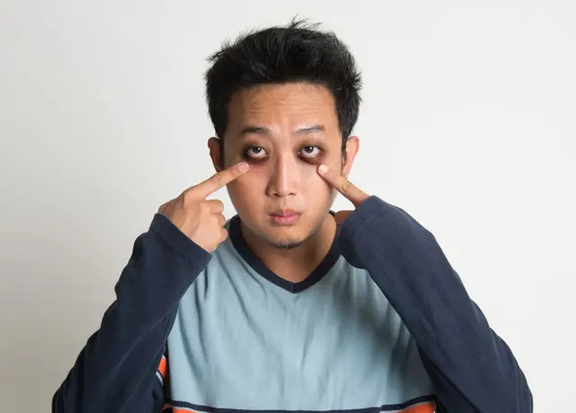 【答个疑】熬夜多严重会导致黑眼圈？