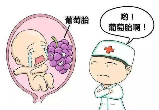 怀孕出血，小心葡萄胎