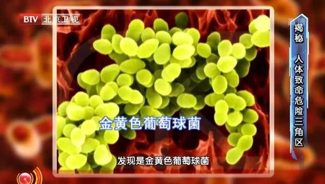 身上2个地方别随便“碰”，一旦受损，可能致命！专家：牙签自测风险，有这种症状赶紧就医