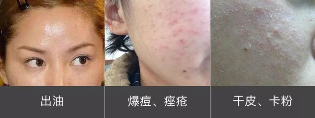 你的脸蛋“一键美颜”，除了滤镜还靠什么？