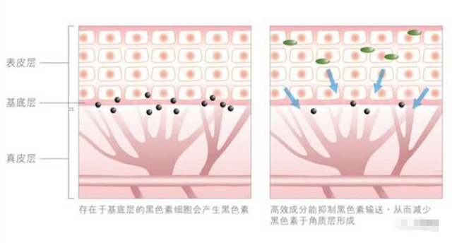 美白针的风险有多高？央视曝光行业“黑幕”，看完以后再也不敢打