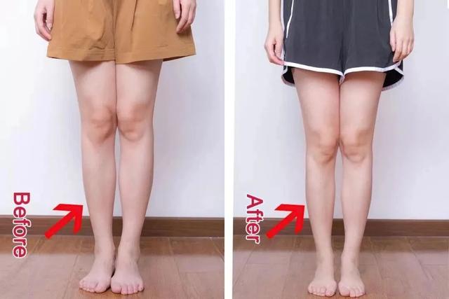 日本变态“腿部抽脂术”，7天小腿瘦3cm，堪比瘦腿针