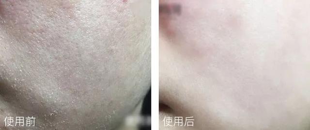 你的脸蛋“一键美颜”，除了滤镜还靠什么？