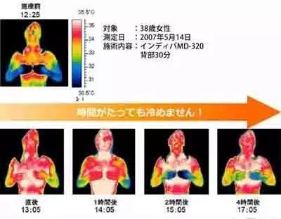 黄金美塑 |将能量覆盖内外细胞的“形体雕塑和健康管理仪”