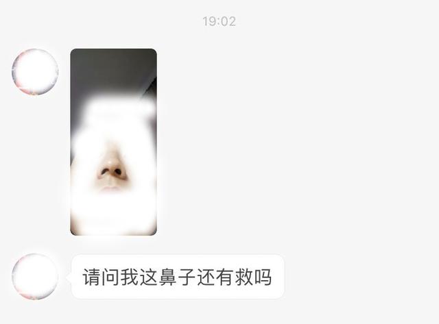 什么是鼻中隔偏曲？如何改善鼻中隔偏曲？