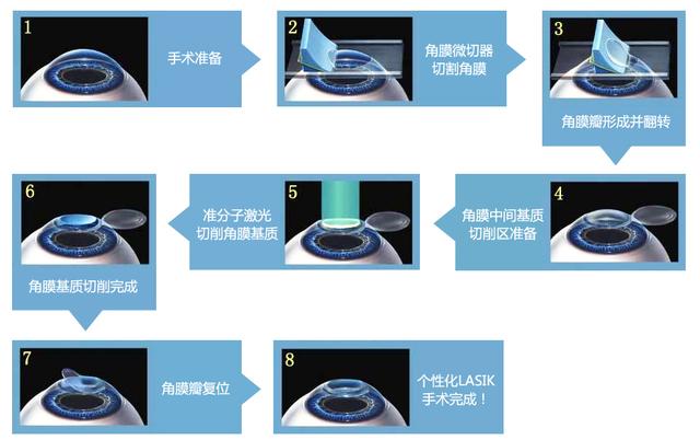 为什么近视低龄化越来越严重？已经得了近视，究竟该不该做手术？