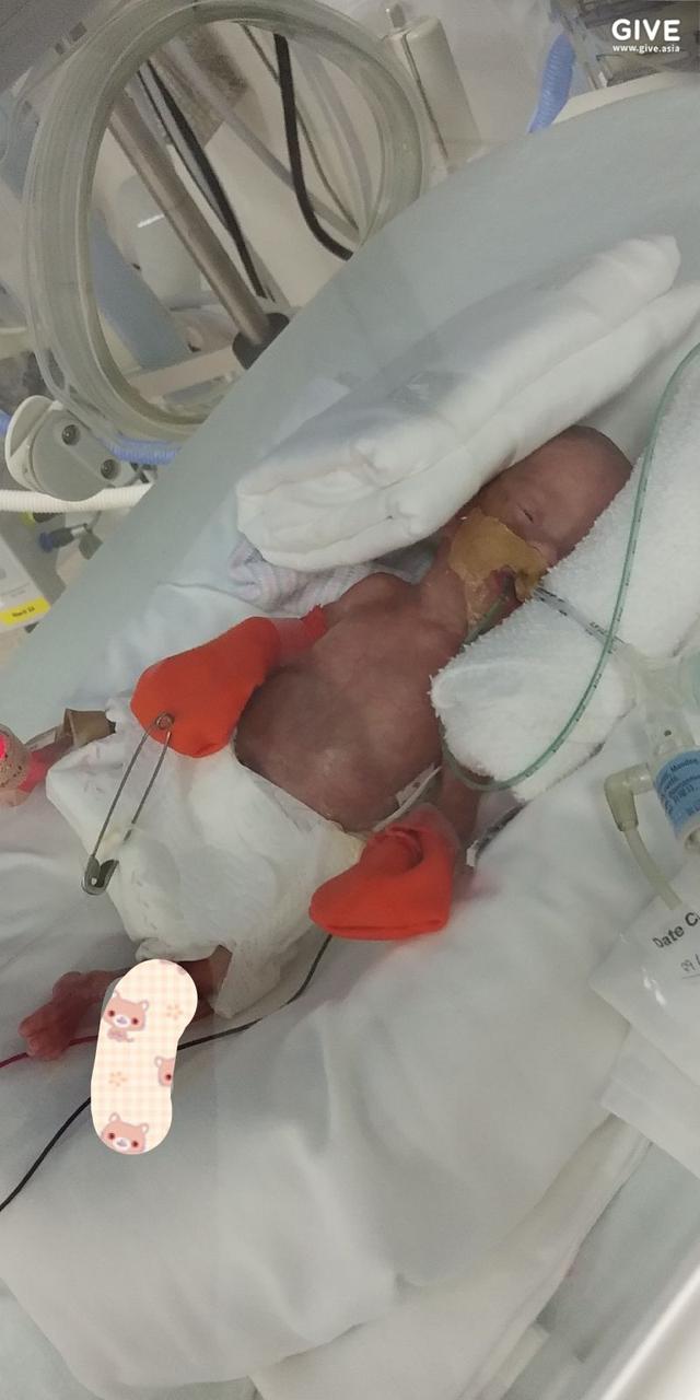 英国宝宝刚出生只有一个苹果重，13个月治疗后，她终于回家了