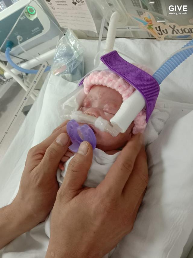 英国宝宝刚出生只有一个苹果重，13个月治疗后，她终于回家了
