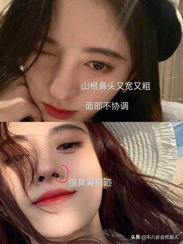 那些乱整鼻子的女明星还好吗？后遗症一大堆，杨幂金晨都开始崩了