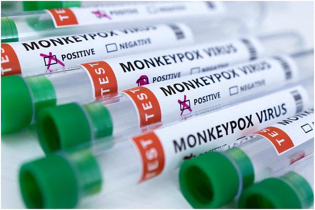 东南亚拉响警报 新加坡确诊猴痘