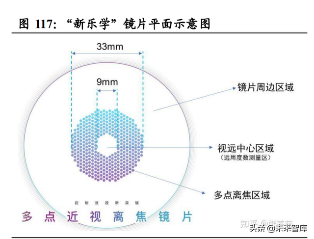 眼镜行业深度报告：眼镜市场千亿规模，近视防控赛道加速崛起