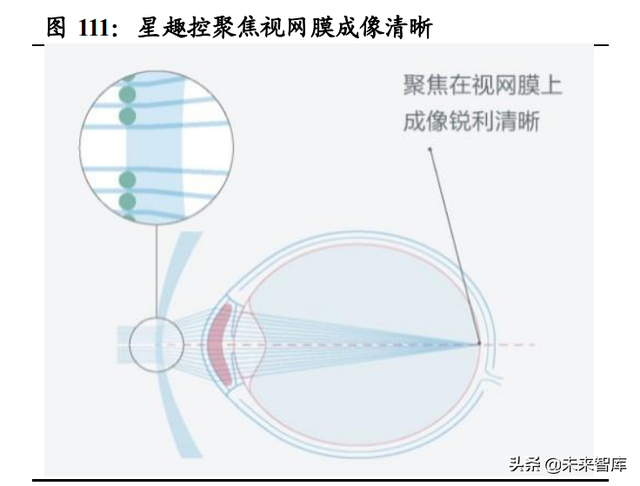 眼镜行业深度报告：眼镜市场千亿规模，近视防控赛道加速崛起