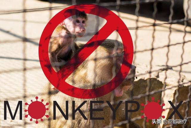 警惕！亚洲已出现猴痘病例！韩国和新加坡首次通报猴痘病例