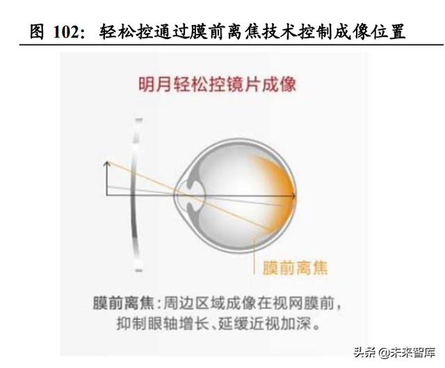 眼镜行业深度报告：眼镜市场千亿规模，近视防控赛道加速崛起