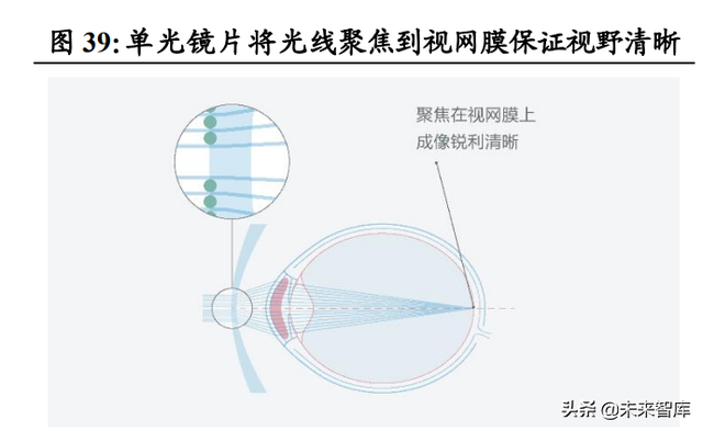 眼镜行业深度报告：眼镜市场千亿规模，近视防控赛道加速崛起