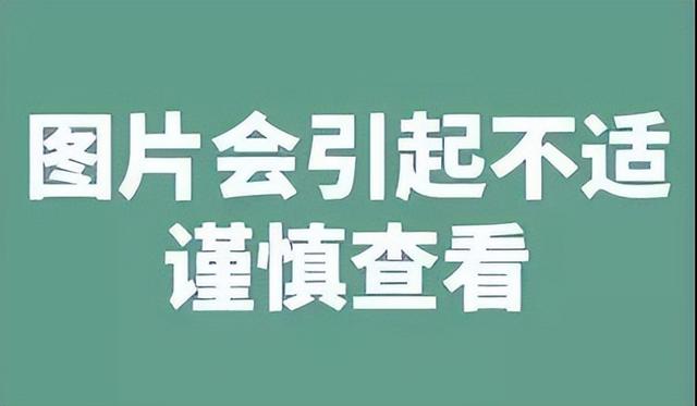 开课了！教你皮肤“发炎”看部位